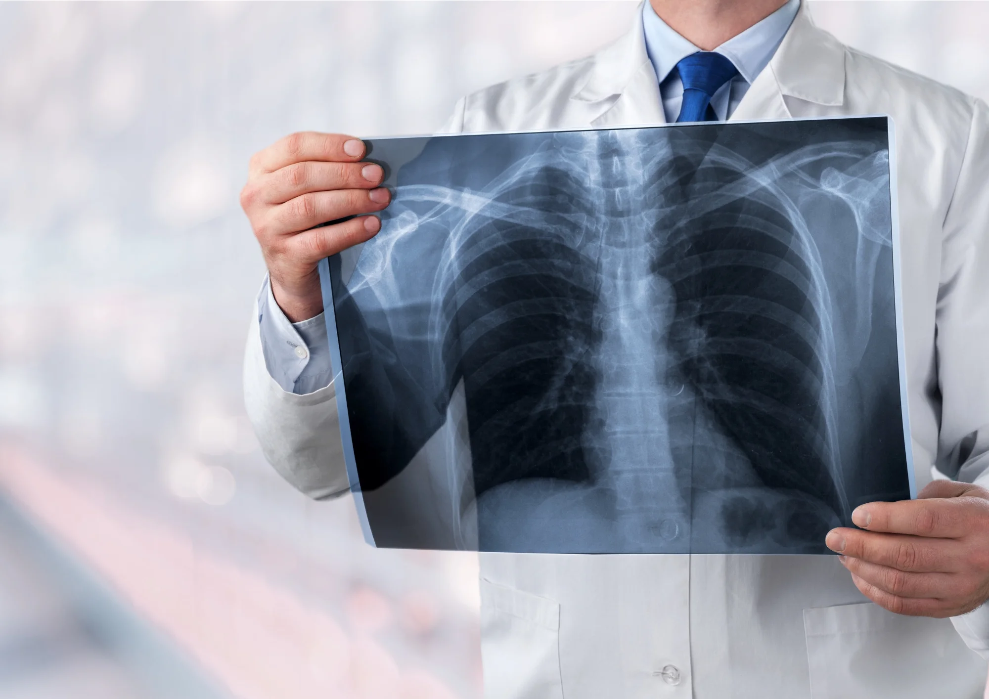 ciberseguridad en dispositivos medicos